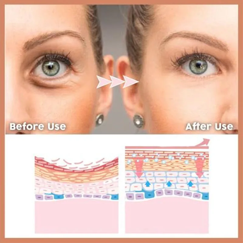 Eye Delight Boost Serum [ 𝐋𝐢𝐦𝐢𝐭𝐞𝐝 Time 𝐎𝐧𝐥𝐲]