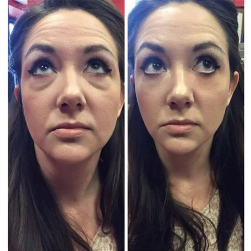 Eye Delight Boost Serum [ 𝐋𝐢𝐦𝐢𝐭𝐞𝐝 Time 𝐎𝐧𝐥𝐲]