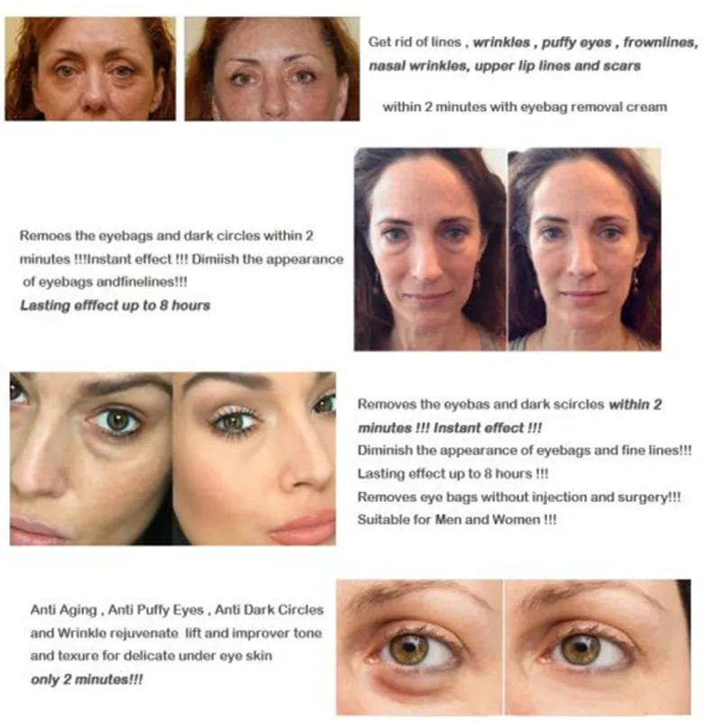 Eye Delight Boost Serum [ 𝐋𝐢𝐦𝐢𝐭𝐞𝐝 Time 𝐎𝐧𝐥𝐲]